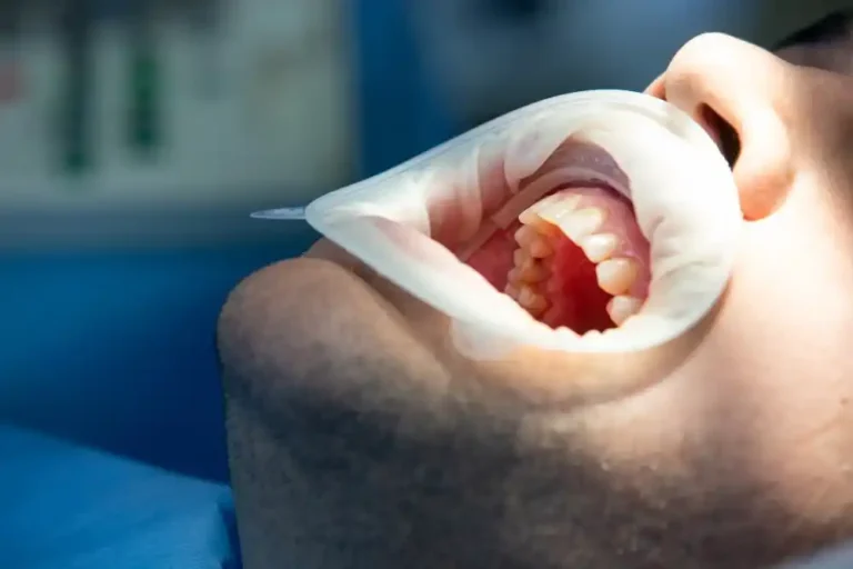endodoncia