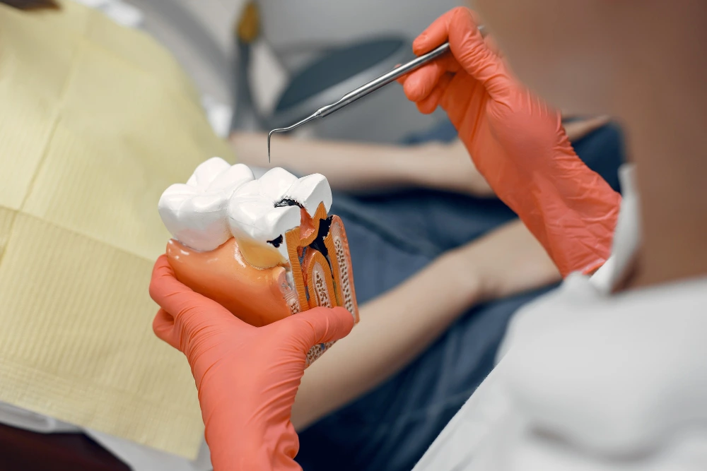 caries
